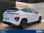 Hyundai Kona N Line Vierwielaandrijving